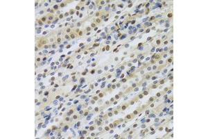 Immunohistochemistry of paraffin-embedded rat kidney using RBBP4 Antibody (ABIN5970697) at dilution of 1/100 (40x lens).