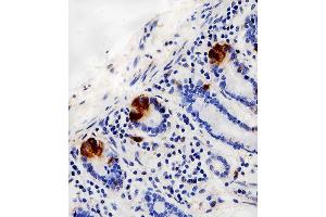 Immunohistochemical analysis of paraffin-embedded H.