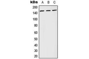 Western blot analysis of PLC gamma 1 (pY783) expression in Jurkat pervanadate-treated (A), NIH3T3 LPS-treated (B), PC12 H2O2-treated (C) whole cell lysates. (Phospholipase C gamma 1 anticorps  (pTyr783))