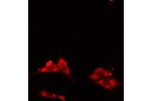 ABIN6275601 staining HepG2 cells by IF/ICC. (Sorting Nexin 3 anticorps  (Internal Region))