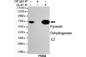 Immunoprecipitation analysis of Hela cell lysates using Pyruvate Dehydrogenase E2 mouse mAb. (CYB561 anticorps)