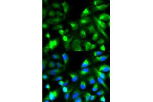 Immunofluorescence analysis of HeLa cell using SNAP25 antibody. (SNAP25 anticorps  (AA 1-206))
