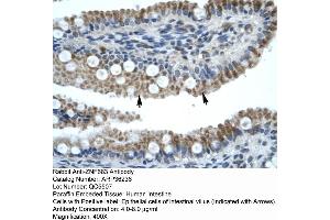 Human Intestine (ZNF683 anticorps  (N-Term))