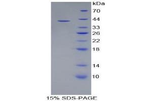 SDS-PAGE (SDS) image for Colony Stimulating Factor 2 Receptor, Alpha, Low-Affinity (Granulocyte-Macrophage) (CSF2RA) (AA 28-112) protein (His tag,GST tag) (ABIN1879796) (CSF2RA Protein (AA 28-112) (His tag,GST tag))