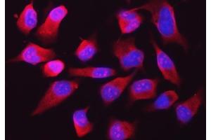 IF analysis of RPL32 using anti-RPL32 antibody (ABIN7602916). (RPL32 anticorps  (C-Term))