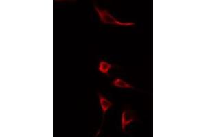 ABIN6275602 staining HuvEc cells by IF/ICC. (Sorting Nexin 4 anticorps  (Internal Region))