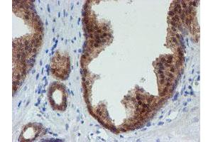 Image no. 9 for anti-Mannose Phosphate Isomerase (MPI) antibody (ABIN1499545) (MPI anticorps)