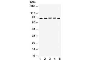 Western blot testing of 1) rat brain, 2) rat testis, 3) human HeLa, 4) SKOV and 5) SW620 lysate with EWSR1 antibody. (EWSR1 anticorps)