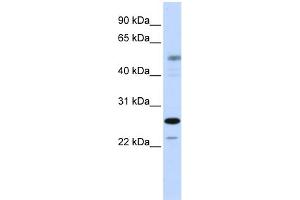 WB Suggested Anti-PSMC3IP Antibody Titration:  0. (PSMC3IP anticorps  (C-Term))