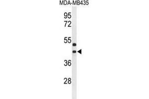 Western blot analysis of GPR17 (arrow) in MDA-MB435 cell line lysates (35ug/lane) using GPR17 (GPR17 anticorps  (Middle Region))