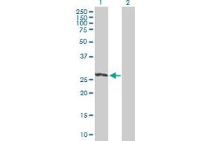 Western Blot analysis of RIT2 expression in transfected 293T cell line by RIT2 MaxPab polyclonal antibody. (RIT2 anticorps  (AA 1-217))