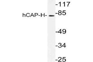 Western blot (WB) analysis of hCAP-H antibody in extracts from K562 cells. (NCAPH anticorps)