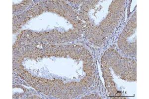 IHC analysis of OCRL using anti-OCRL antibody (ABIN7599572). (OCRL anticorps  (AA 1-901))