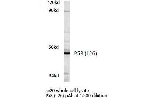 Western blot (WB) analyzes of P53 antibody in extracts from SP20 cells. (p53 anticorps)