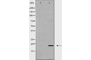 Western blot analysis of CD3 ζ expression in Jurkat cell lysate . (CD247 anticorps  (C-Term))