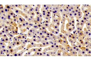 Detection of GSTM1 in Rat Liver Tissue using Polyclonal Antibody to Glutathione S Transferase Mu 1 (GSTM1)