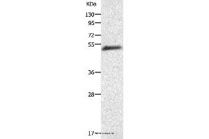 Western blot analysis of Human liver cancer tissue, using AGT Polyclonal Antibody at dilution of 1:200 (AGT anticorps)
