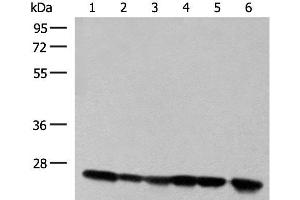 Western blot analysis of 293T cell and Human fetal liver tissue lysates using DTYMK Polyclonal Antibody at dilution of 1:550 (DTYMK anticorps)