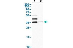 Western Blot analysis with SLAMF6 polyclonal antibody . (SLAMF6 anticorps  (AA 152-224))