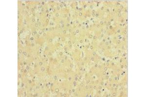 Immunohistochemistry of paraffin-embedded human liver tissue using ABIN7147993 at dilution of 1:100 (Factor XI anticorps  (AA 19-387))