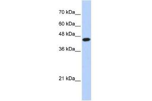WB Suggested Anti-E2F1 Antibody Titration:  0. (E2F1 anticorps  (N-Term))