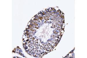 IHC analysis of KIFC1 using anti-KIFC1 antibody (ABIN7599523). (KIFC1 anticorps  (AA 1-673))