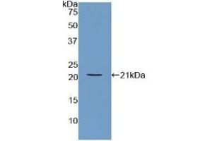 Detection of Recombinant ARPC4, Human using Polyclonal Antibody to Actin Related Protein 2/3 Complex Subunit 4 (ARPC4) (ARPC4 anticorps  (AA 3-165))