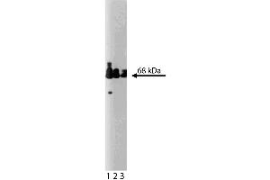 Western blot analysis of Paxillin on a human endothelial lysate. (Paxillin anticorps  (AA 1-557))