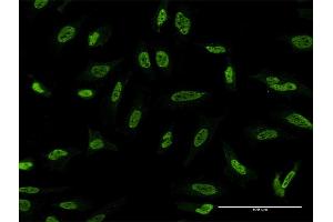 Immunofluorescence of monoclonal antibody to STK24 on HeLa cell. (STK24 anticorps  (AA 1-431))