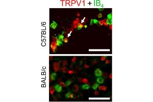 Western blot analysis of human TRPV1 transfected  cells:1.