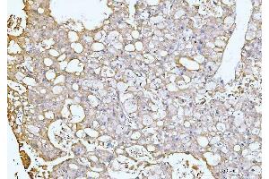 IHC analysis of GNB3 using anti-GNB3 antibody (ABIN7599726).