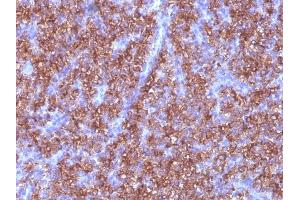 Formalin-fixed, paraffin-embedded human Parathyroid stained with Chromogranin A Monoclonal Antibody (CGA/413)