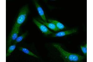 IF analysis of GSDMD using anti-GSDMD antibody (ABIN7599433). (GSDMD anticorps  (AA 1-484))