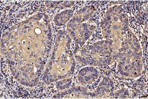 IHC analysis of PDIA6 using anti-PDIA6 antibody (ABIN7600554). (PDIA6 anticorps  (AA 20-440))