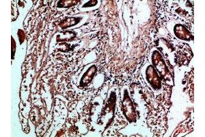 Immunohistochemical analysis of paraffin-embedded Human-colon, antibody was diluted at 1:100 (HLA-DMB anticorps  (AA 40-100))
