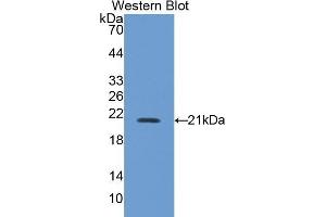Detection of Recombinant NOS2, Mouse using Polyclonal Antibody to Nitric Oxide Synthase 2, Inducible (NOS2) (NOS2 anticorps  (AA 43-213))