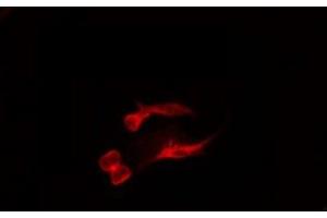 ABIN6275094 staining MCF7 by IF/ICC. (RNF138 anticorps  (Internal Region))
