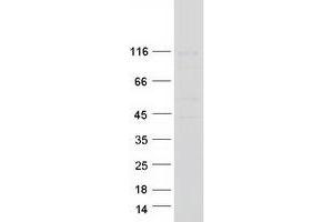 Validation with Western Blot