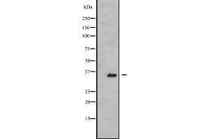 Western blot analysis of TSSK3 expression in A431 whole cell lysate ,The lane on the left is treated with the antigen-specific peptide. (TSSK3 anticorps  (N-Term))