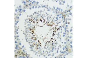 Immunohistochemistry of paraffin-embedded mouse testis using TRIP12 antibody (ABIN6129753, ABIN6149543, ABIN6149544 and ABIN6225295) at dilution of 1:100 (40x lens). (TRIP12 anticorps  (AA 1-240))