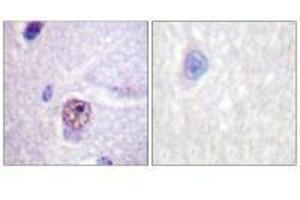 Immunohistochemistry analysis of paraffin-embedded human brain tissue using SF1 (Ab-82) antibody.