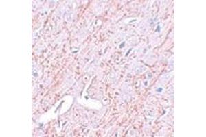 Immunohistochemistry of GATA3 in rat brain tissue with GATA3 antibody at 2. (GATA3 anticorps  (C-Term))