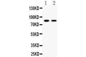 Anti- Mitofusin-2 Picoband antibody, Western blotting All lanes: Anti Mitofusin-2  at 0.