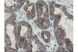 Image no. 3 for anti-RIO Kinase 2 (RIOK2) (AA 277-552) antibody (ABIN1491304) (RIOK2 anticorps  (AA 277-552))