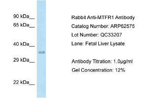 Western Blotting (WB) image for anti-Mitochondrial Fission Regulator 1 (MTFR1) (C-Term) antibody (ABIN971200) (MTFR1 anticorps  (C-Term))