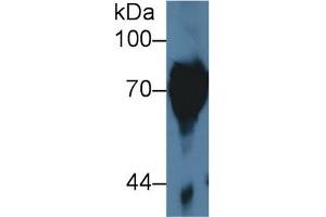 Detection of CAP3 in Human Serum using Polyclonal Antibody to Cytoplasmic Antiproteinase 3 (CAP3)