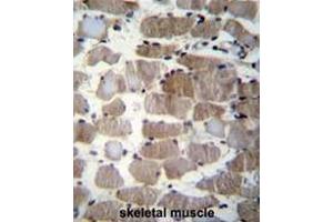 Formalin fixed and paraffin embedded human skeletal muscle stained with CTSK Antibody (Center) followed by peroxidase conjugation of the secondary antibody and DAB staining.