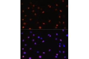 Immunofluorescence analysis of C6 cells using J/CSN5/J/CSN5/COPS5 antibody  at dilution of 1:100.