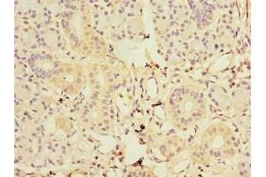 Immunohistochemistry of paraffin-embedded human pancreatic tissue using ABIN7153583 at dilution of 1:100 (GDAP1L1 anticorps  (AA 101-260))