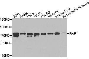 Western blot analysis of extracts of various cell lines, using RAF1 antibody (ABIN5970053) at 1/1000 dilution. (RAF1 anticorps  (C-Term))